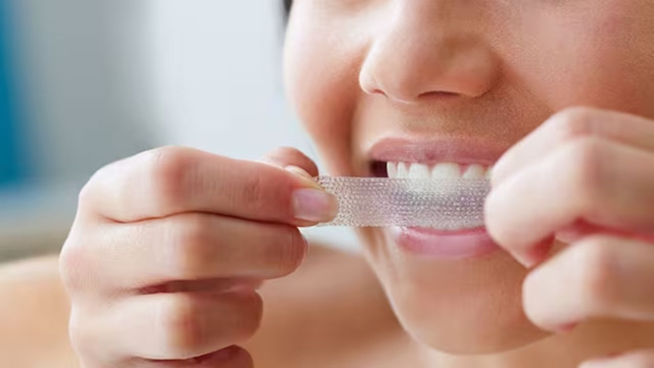 Exploring Teeth Whitening Strips Wholesale Advantages