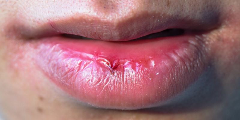 Say Goodbye to Dry Mouth: Simple Tips for Everyday Relief